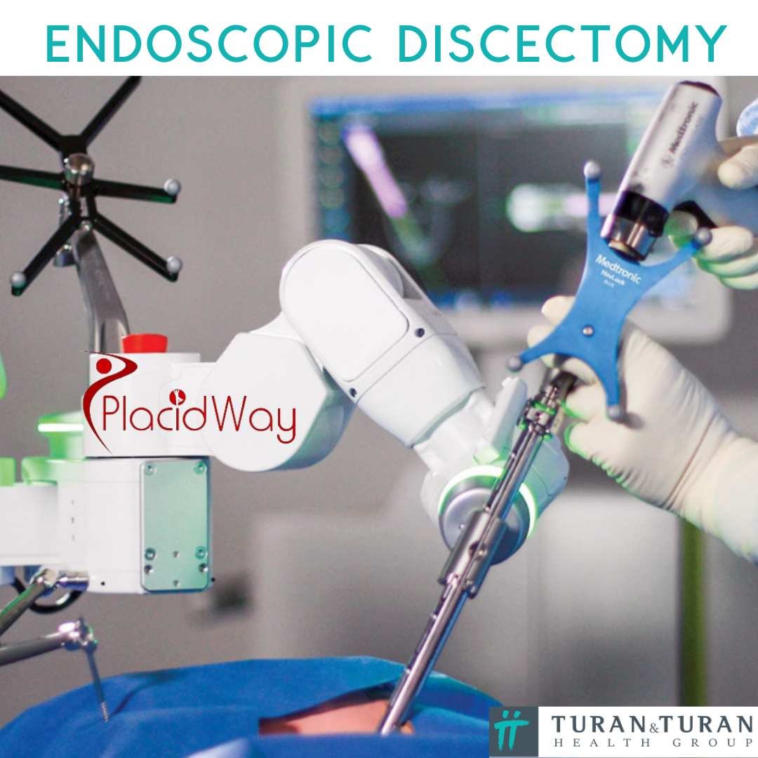 Endoscopic Discectomy surgery at Turan Turan Clinic in Bursa, Turkey