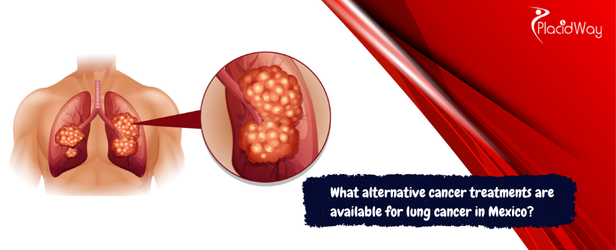 Alternative Lung Cancer Treatments in Mexico: Immunotherapy, Hyperthermia, Metabolic Therapy, Stem Cells