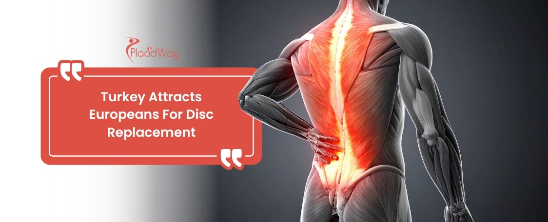 Cervical Disc Replacement in Turkey