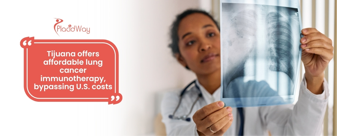 Lung Cancer Immunotherapy in Tijuana