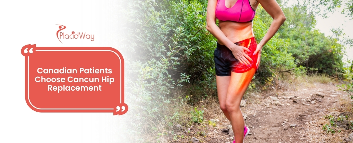 Hip Replacement in Cancun