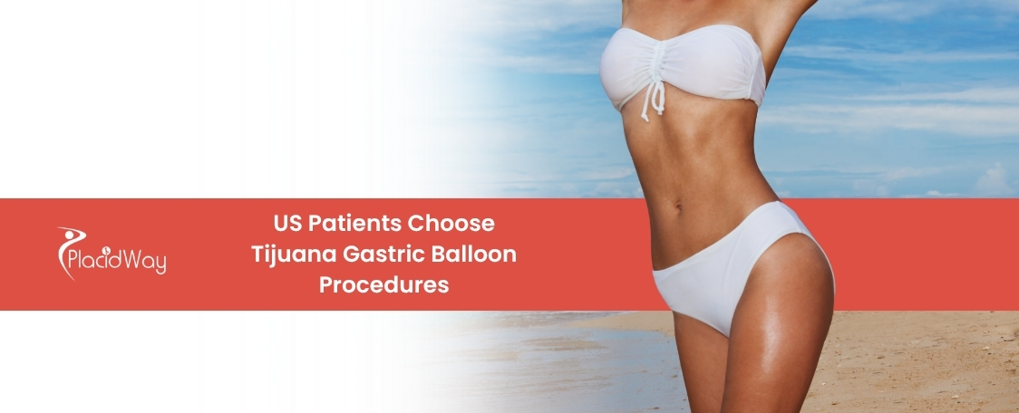 Gastric Balloon in Tijuana