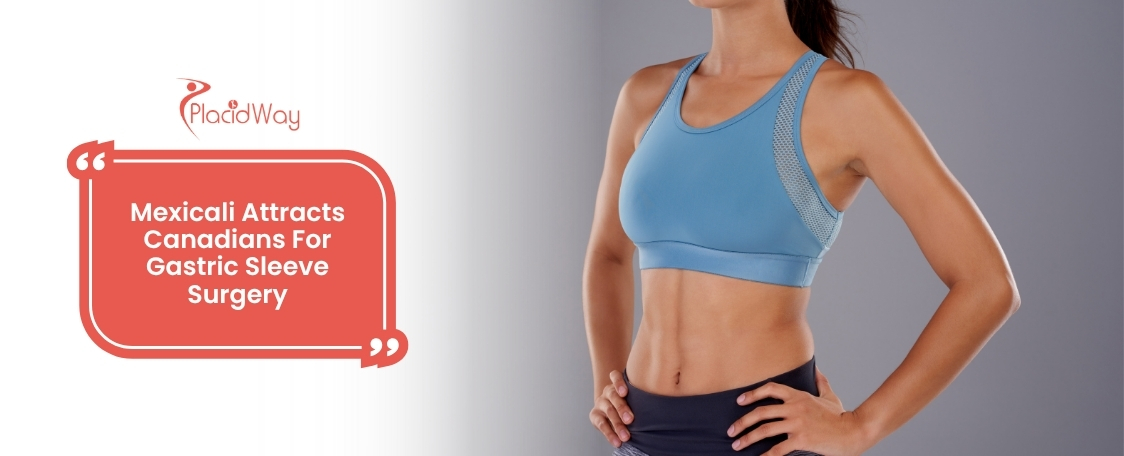 Gastric Sleeve Surgeries in Mexicali