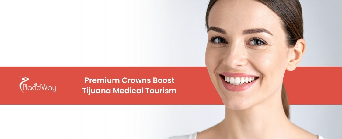 Dental Crowns in Tijuana