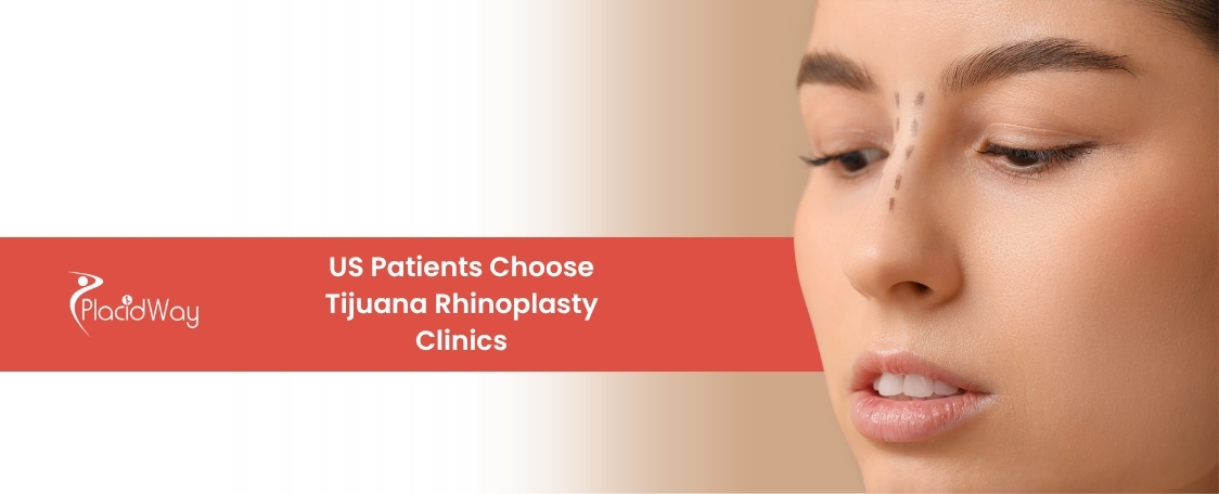 rhinoplasty in Tijuana, Mexico