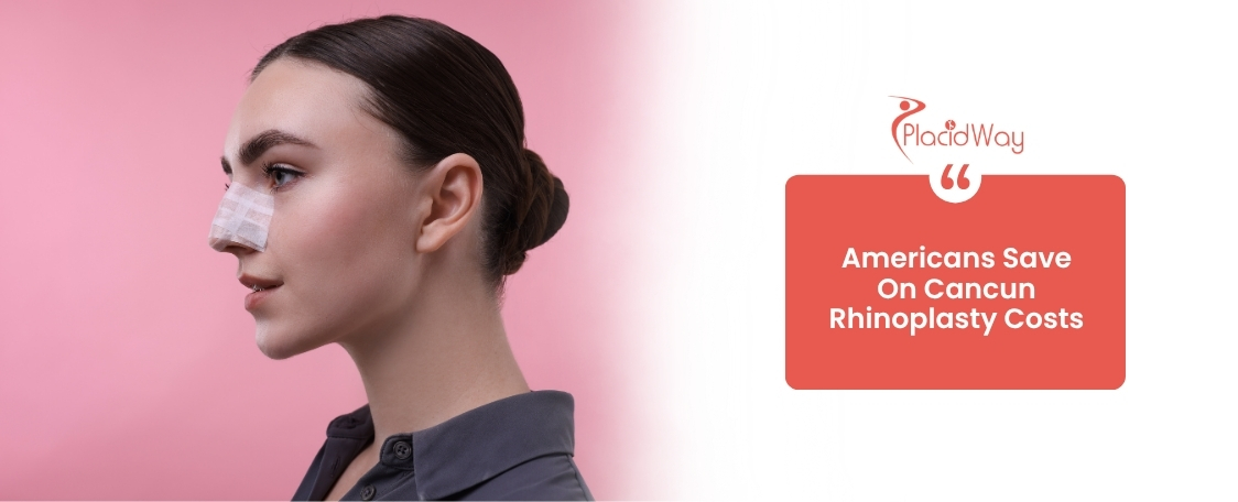 Rhinoplasty in Cancun