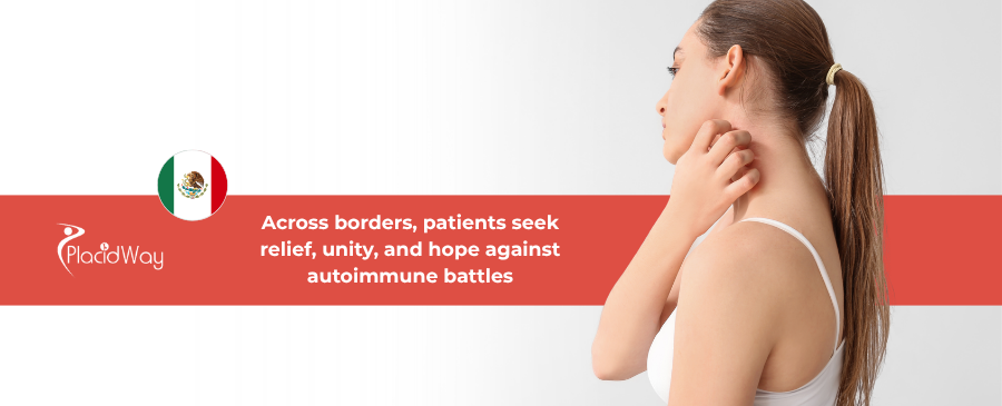 Autoimmune Diplomacy: Tijuana’s Medical Corridor Sees Record U.S. Lupus Patient Admissions