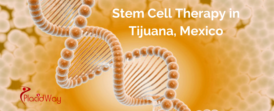 Stem Cell Tijuana: Affordable & High-Quality Treatments