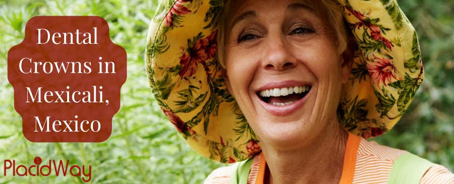 Coronas dentales en Mexicali: las mejores clínicas dentales y dentistas