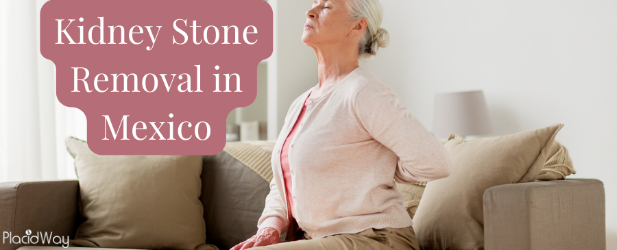 Cirugía para eliminar cálculos renales en México