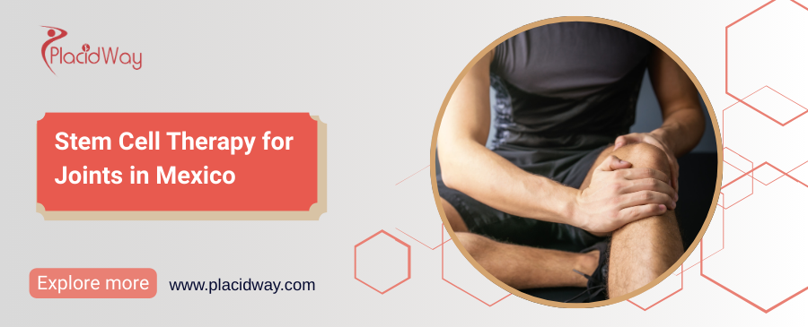 Terapia con células madre para las articulaciones en México