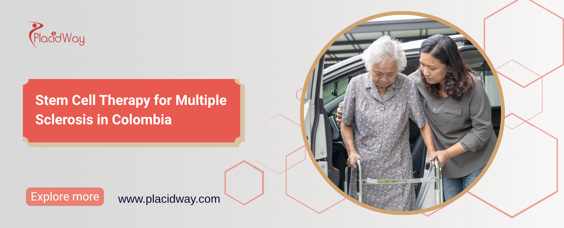 Terapia con células madre para la esclerosis múltiple en Colombia