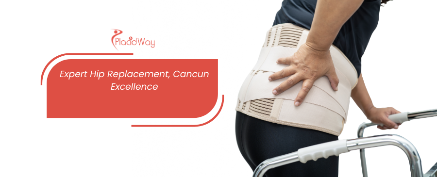 Hip Replacement in Mexico: Your Guide to Affordable and Quality Care