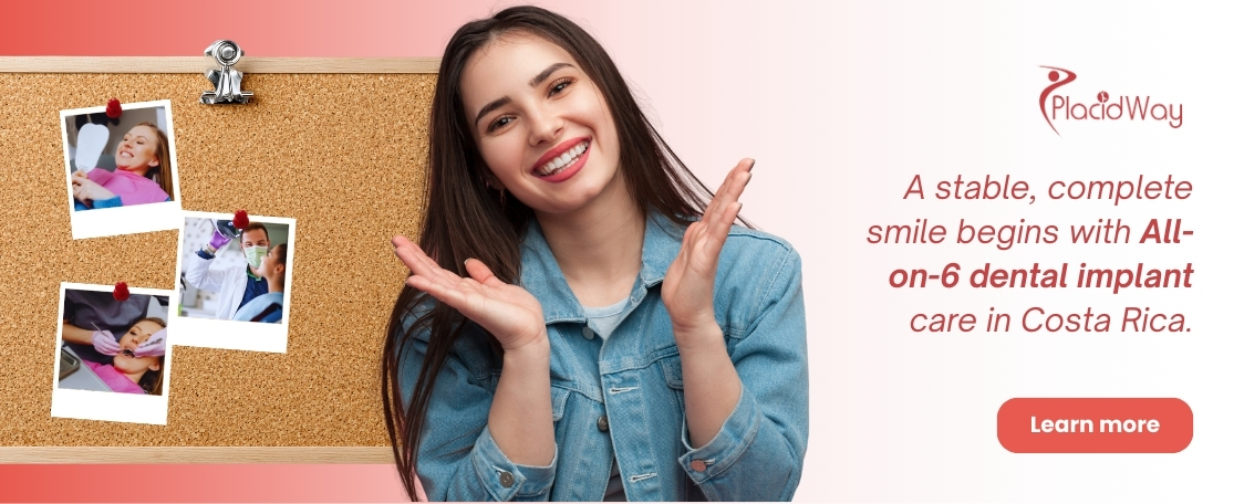 Implantes dentales All on 6 en Costa Rica