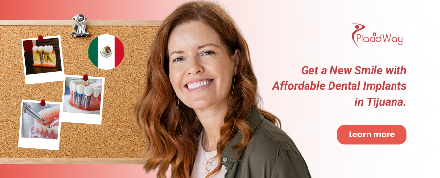 Affordable Dental Implants in Tijuana, Mexico