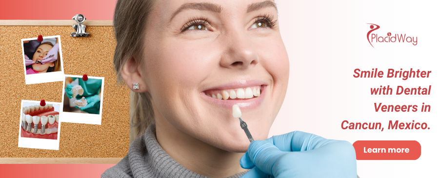 Dental Veneers in Cancun, Mexico