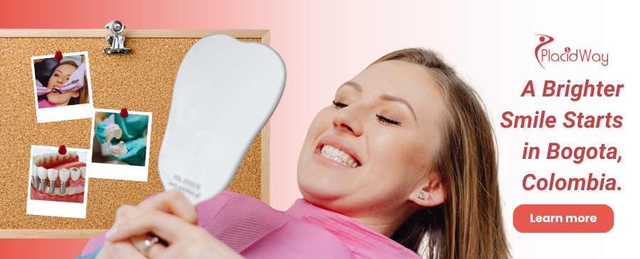 Carillas dentales en Bogotá Colombia