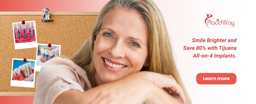 Implantes dentales All on 4 en Tijuana, México | Ahorra 80%