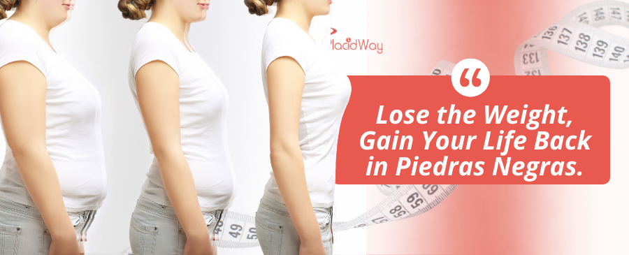 Cirugía de Manga Gástrica en Piedras Negras, México