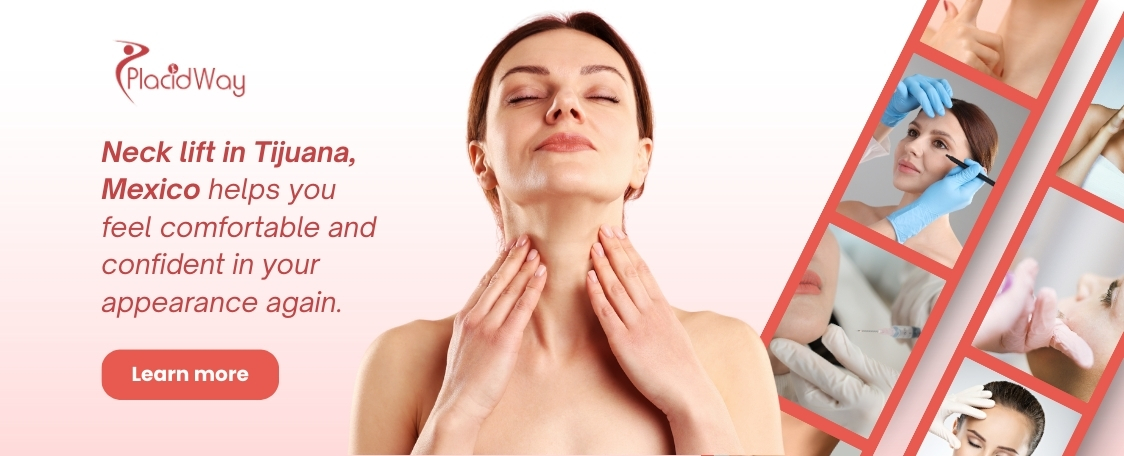 Lifting de cuello en Tijuana México