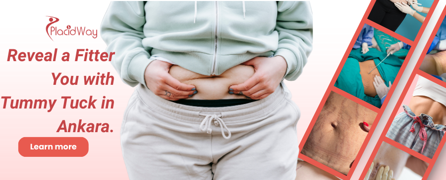 Abdominoplastia en Ankara, Turquía