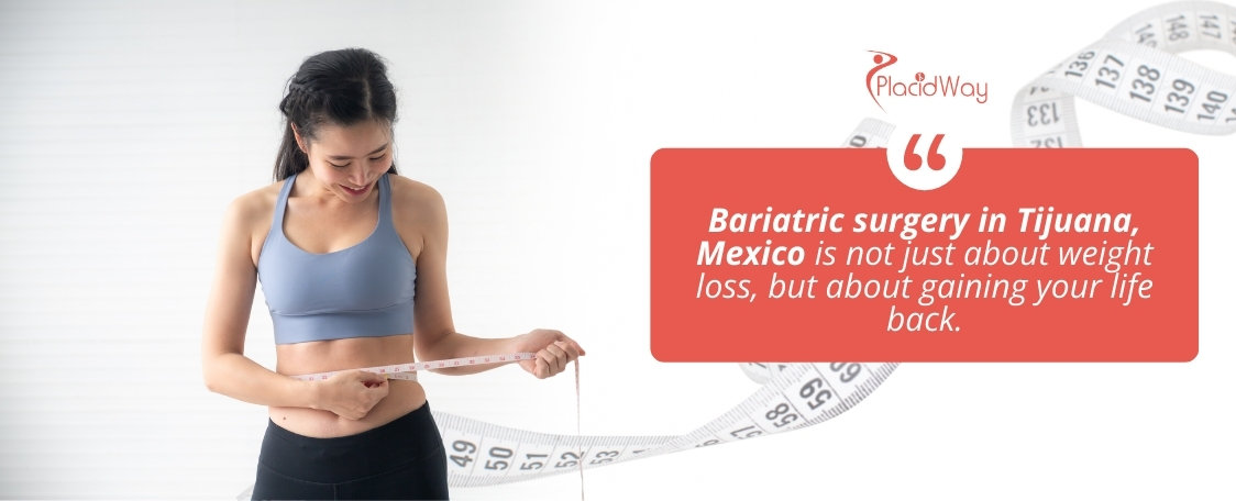 Cirugía Bariátrica en Tijuana, México