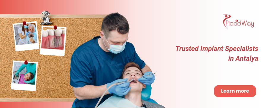 Implantes dentales All on 4 en Antalya