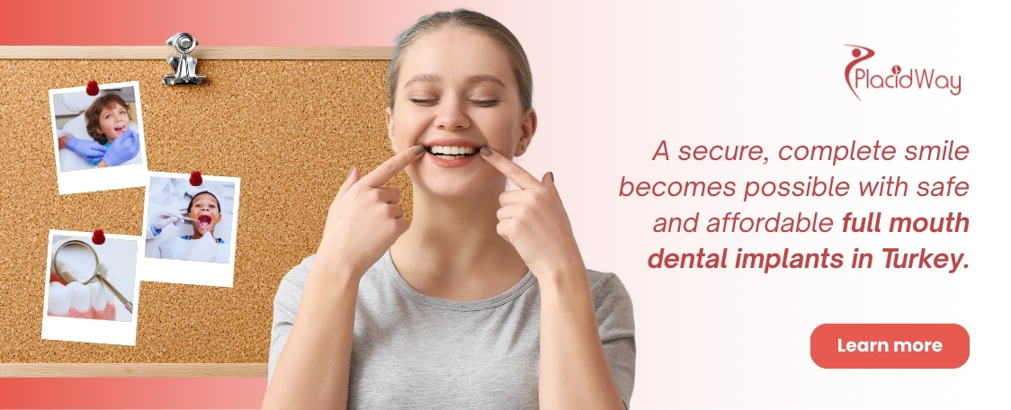 Full Mouth Dental Implants in Turkey - Affordable and Safe