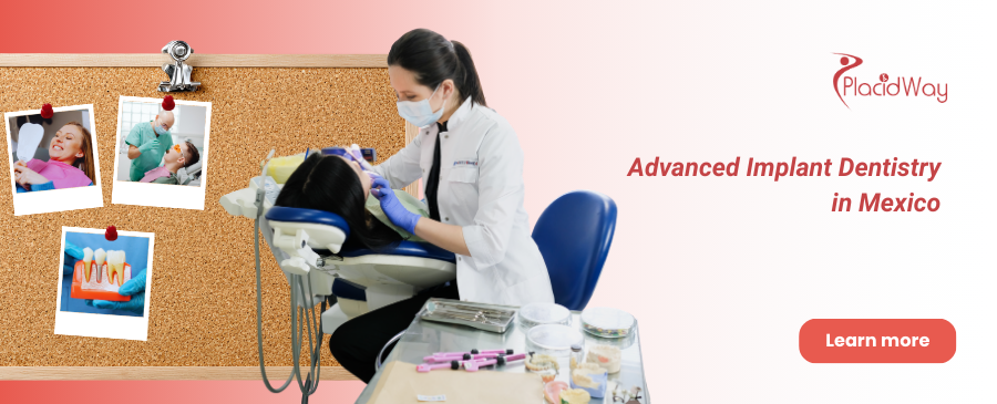 Implantes dentales All on 6 en Cancún, México