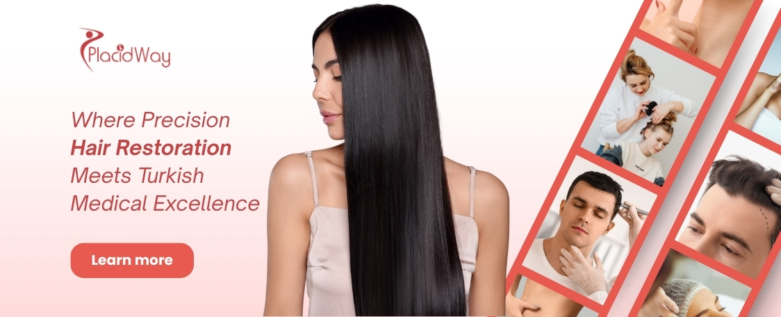 Trasplante capilar FUE en Turquía