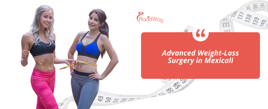 Mini bypass gástrico en Mexicali, México