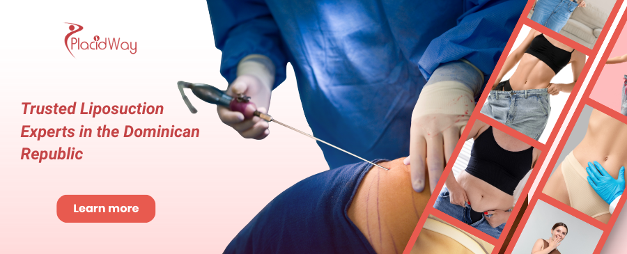 Liposucción en Santo Domingo, República Dominicana
