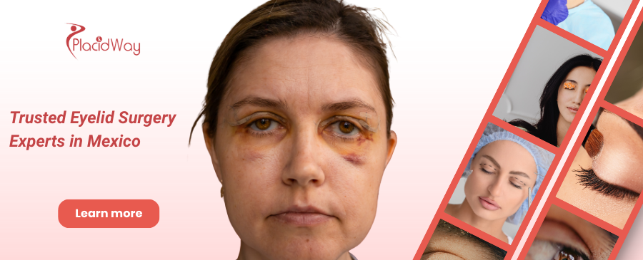 Cirugía de párpados en Tijuana, México