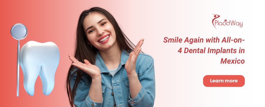 Implantes dentales All on 4 en México