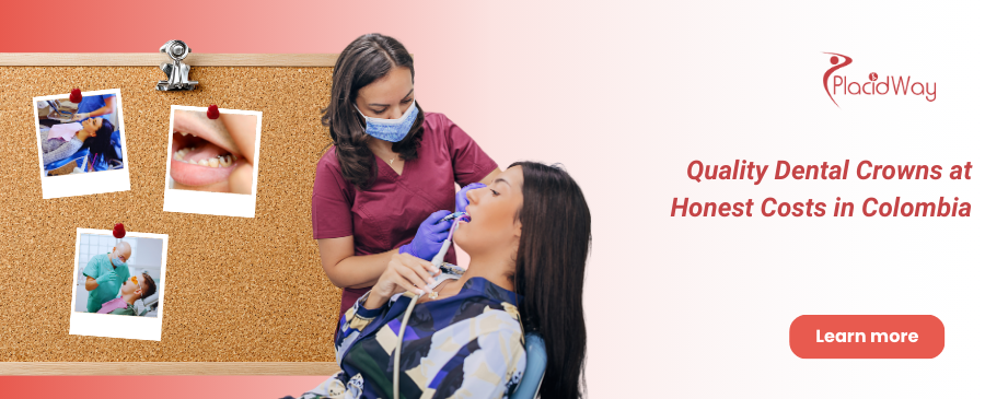 Coronas dentales en Bogotá Colombia