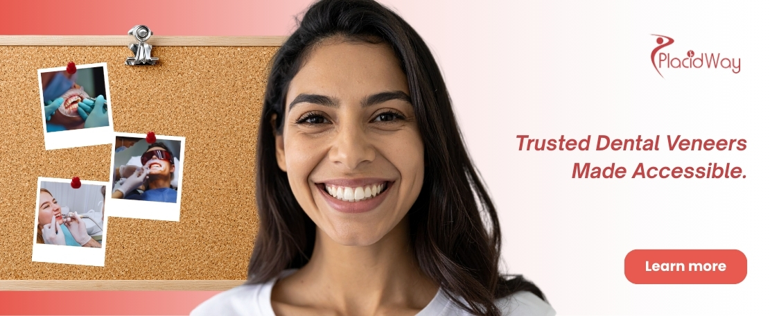 Obtenga carillas dentales baratas y seguras en Colombia