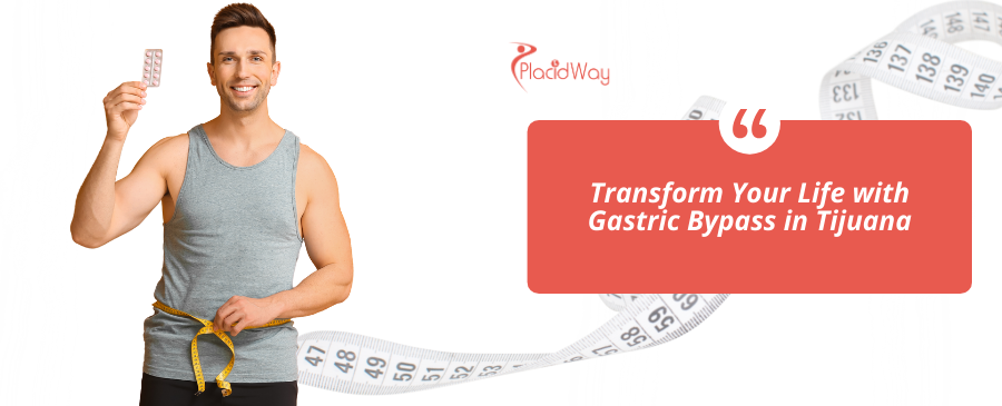 Bypass gástrico en Tijuana, México