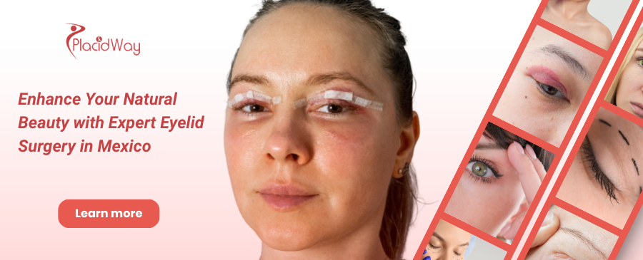 Cirugía de párpados en la Ciudad de México, México