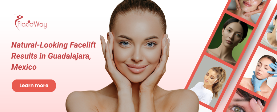 Rejuvenecimiento facial en Guadalajara, México
