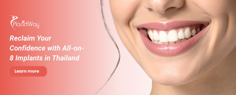 All on 8 Dental Implants in Thailand - Get Dental Implants Abroad 