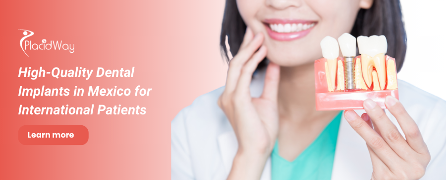 Dental Implants in Mexico