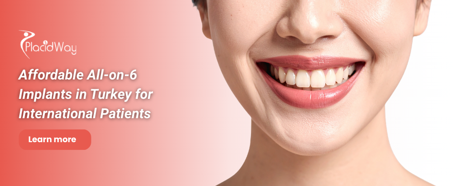 Implantes dentales All on 6 en Turquía