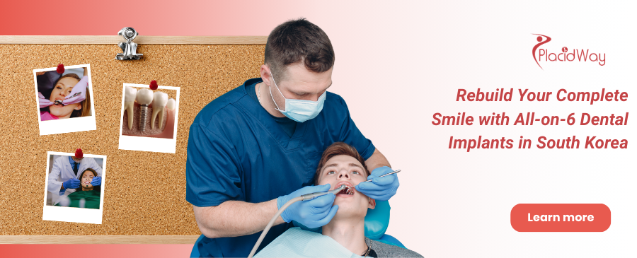 All-on-6 Dental Implant in South Korea