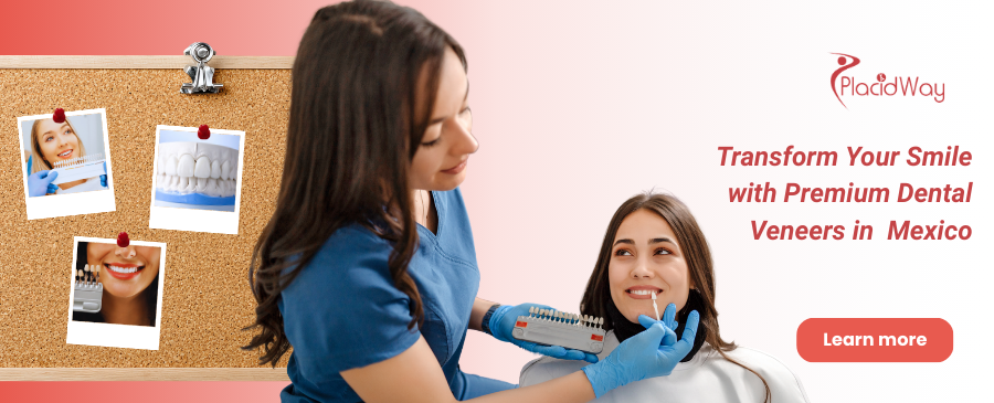 Carillas dentales en Juárez, México