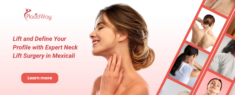 Neck Lift in Mexicali, Mexico
