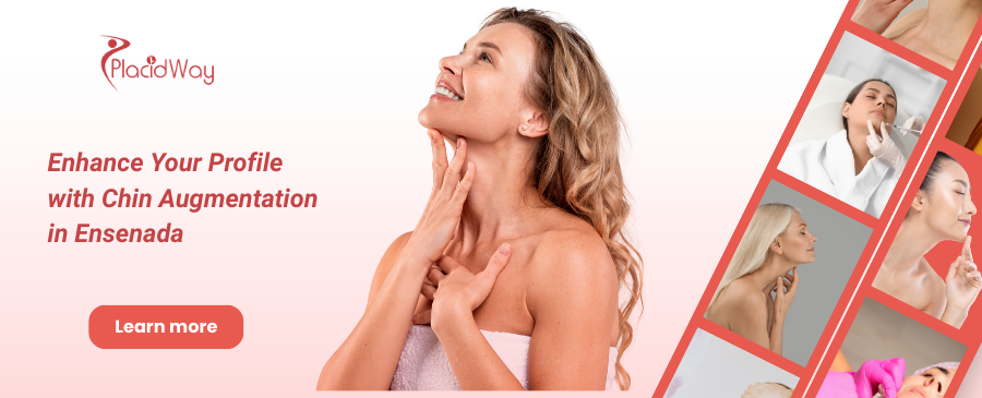 Chin Augmentation in Ensenada, Mexico