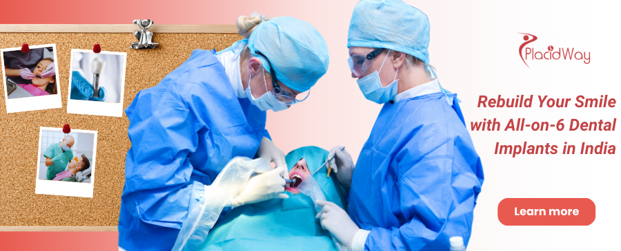 All-on-6 Dental Implants in Mumbai, India