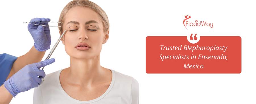 Blepharoplasty in Ensenada, Mexico