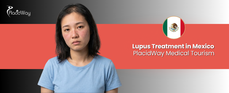 Lupus Treatment in Mexico