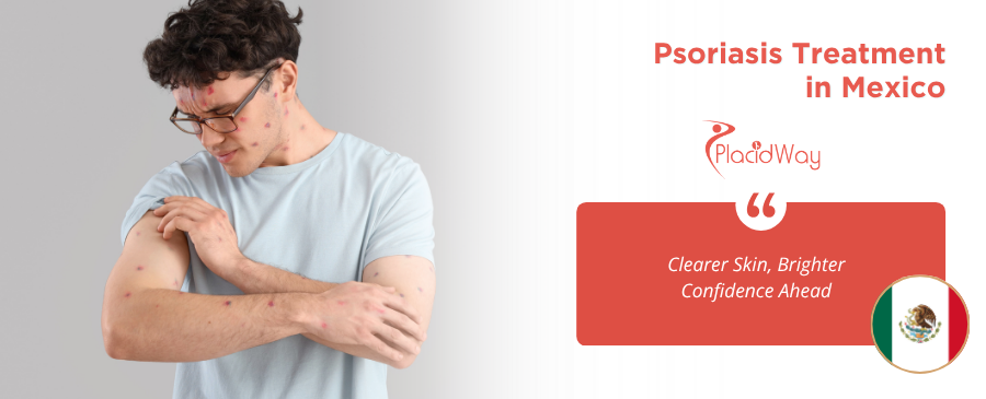 Psoriasis Treatment in Mexico